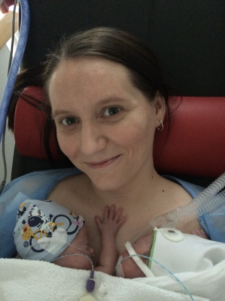 Frühchen SSW23 kuscheln Zwillinge CPAP