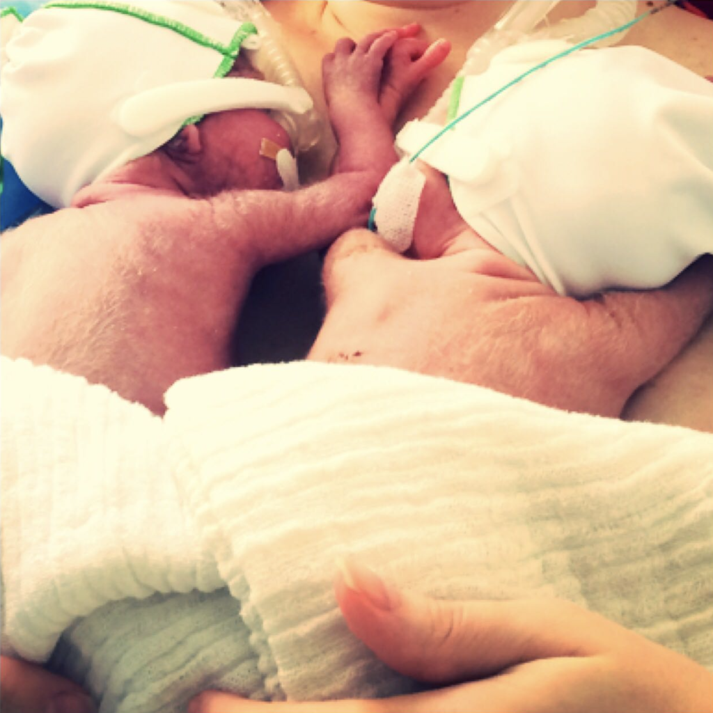 Frühchen SSW23 kuscheln CPAP