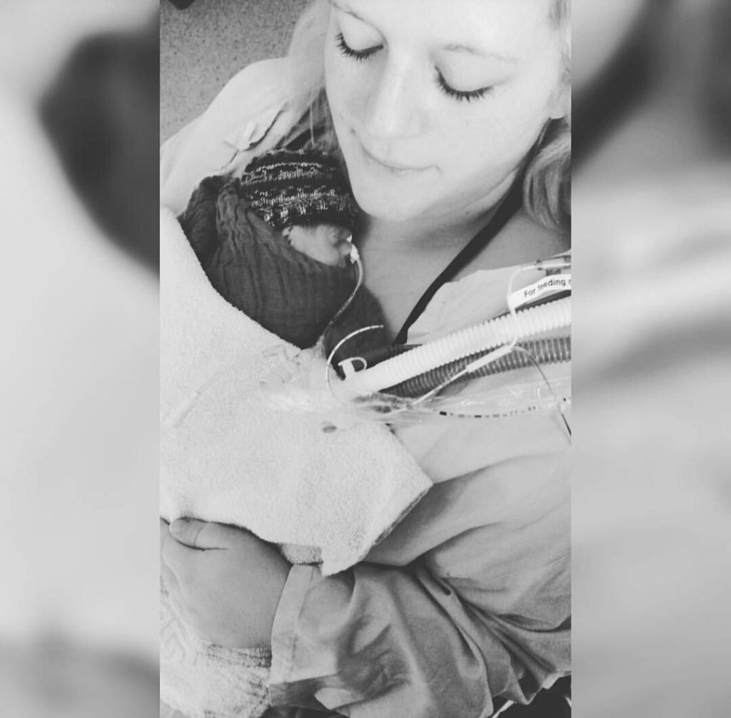 Frühchen Frühgeburt SSW23 Beatmung Extremfrühchen