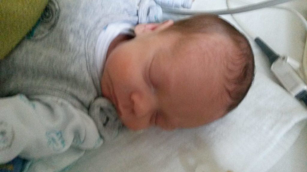Frühchen SSW29 CPAP